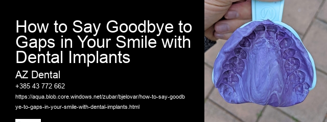 How to Say Goodbye to Gaps in Your Smile with Dental Implants