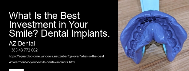 What Is the Best Investment in Your Smile? Dental Implants.